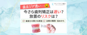 悪い歯並びの原因と放置するリスクとは？今からでも遅くない！歯列矯正の種類と始め方